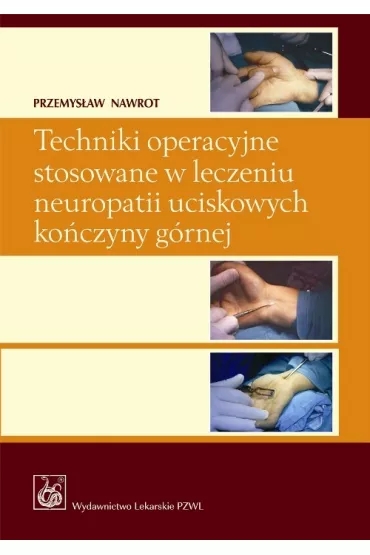 Techniki operacyjne stosowane w leczeniu neuropatii uciskowych ko�czyny g�rnej - Przemys�aw Nawrot