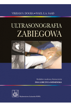 Ultrasonografia zabiegowa