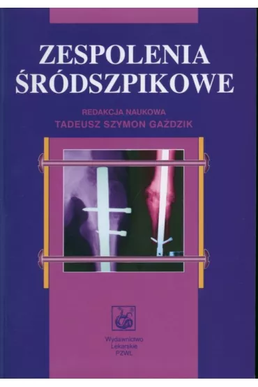 Zespolenia �r�dszpikowe - Szymon Ga�dzik