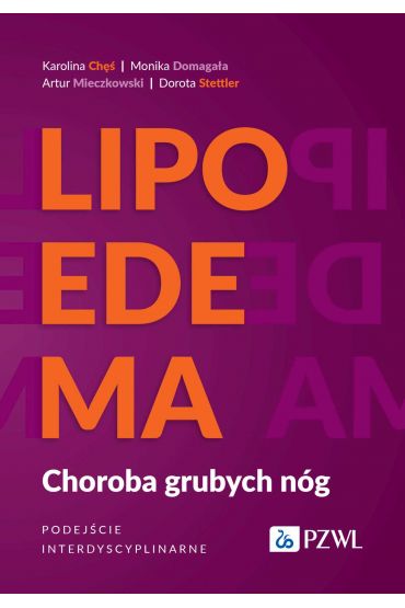 Lipoedema. Choroba grubych nóg. Podejście interdyscyplinarne