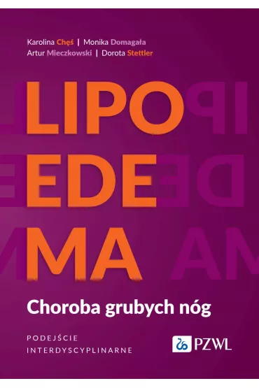 Lipoedema. Choroba grubych n�g. Podej�cie interdyscyplinarne - Artur  Mieczkowski, Dorota  Stettler, Karolina  Ch�, Monika  Domaga�a