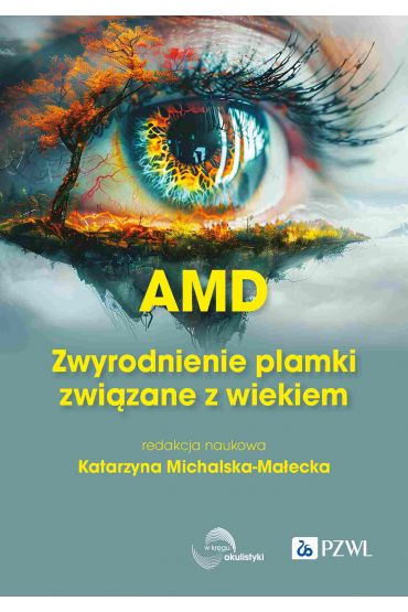 AMD Zwyrodnienie plamki żółtej związane z wiekiem