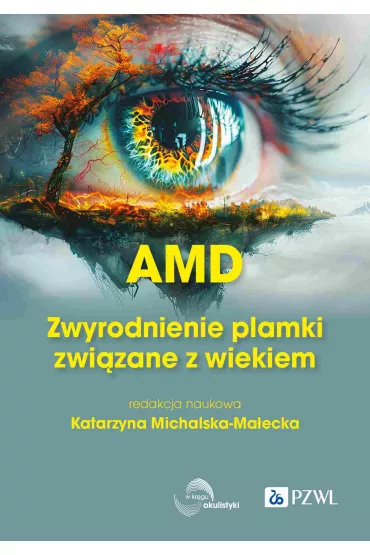 AMD Zwyrodnienie plamki ��tej zwi�zane z wiekiem - Katarzyna Michalska-Ma�ecka