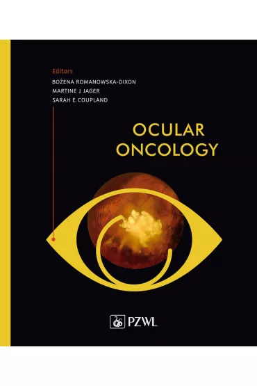 Ocular Oncology - Bo�ena Romanowska-Dixon