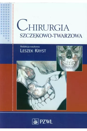 Chirurgia szcz�kowo-twarzowa - Leszek Kryst