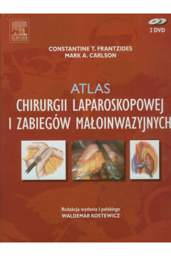 Atlas chirurgii laparoskopowej i zabiegw maoinwazyjnych