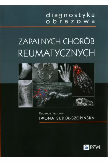Diagnostyka obrazowa zapalnych chor�b reumatycznych