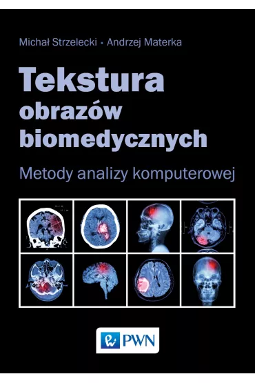 Tekstura obraz�w biomedycznych. Metody analizy komputerowej - Micha� Strzelecki, Andrzej Materka