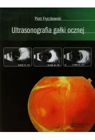 Ultrasonografia ga�ki ocznej