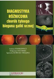 Diagnostyka r�nicowa chor�b tylnego bieguna ga�ki ocznej