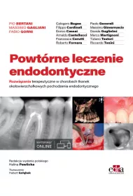 Powt�rne leczenie endodontyczne