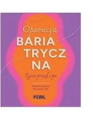 Operacja bariatryczna. �ycie przed i po