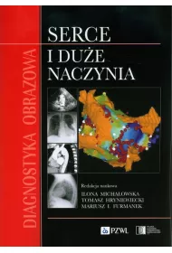 Diagnostyka obrazowa Serce i du�e naczynia