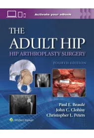 The Adult Hip: Hip Arthroplasty Surgery Print + eBook with Multimedia