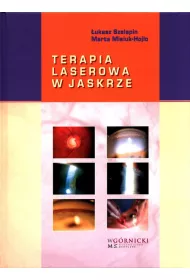 Terapia laserowa w jaskrze