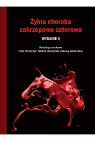 ylna choroba zakrzepowo-zatorowa