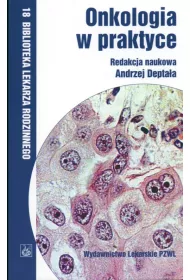 Onkologia w praktyce