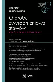 Choroba zwyrodnieniowa staww. Wspczesne spojrzenie. Choroby reumatyczne. W gabinecie lekarza specjalisty
