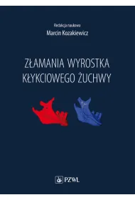 Z�amania wyrostka k�ykciowego �uchwy