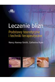 Leczenie blizn pourazowych