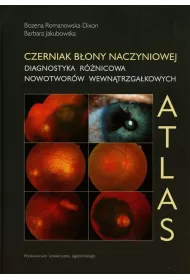 Czerniak bony naczyniowej. Diagnostyka rnicowa