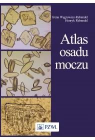 Atlas osadu moczu