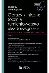 Obrazy kliniczne tocznia rumieniowatego ukadowego. Cz 2. Na podstawie opisw przypadkw. Choroby reumatyczne. W gabinecie lekarza specjalisty