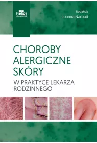 Choroby alergiczne sk�ry w praktyce lekarza rodzinnego