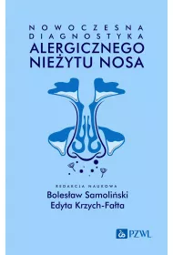 Nowoczesna diagnostyka alergicznego nie�ytu nosa