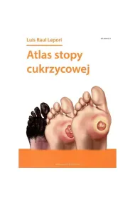 Atlas stopy cukrzycowej