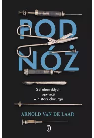 Pod n�. 28 niezwyk�ych operacji w historii chirurgii
