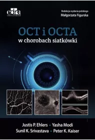 Oct i octa w chorobach siatk�wki