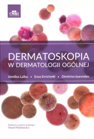 Dermatoskopia w dermatologii og�lnej