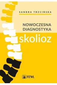 eBook Nowoczesna diagnostyka skolioz mobi epub