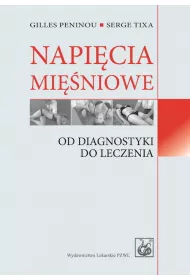 Napi�cia mi�niowe. Od diagnostyki do leczenia