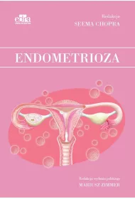 Endometrioza