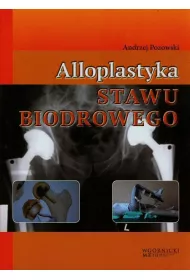 Alloplastyka stawu biodrowego