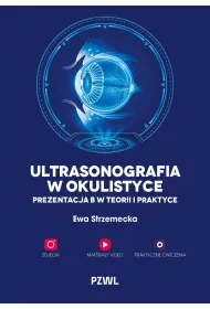 Ultrasonografia w okulistyce. Prezentacja B w teorii i praktyce