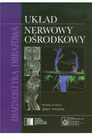 Diagnostyka obrazowa Uk�ad nerwowy o�rodkowy