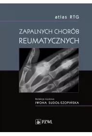 Atlas RTG zapalnych chor�b reumatycznych