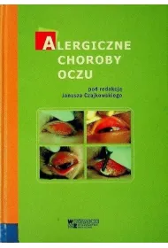 Alergiczne choroby oczu