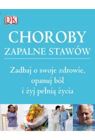 Choroby zapalne staw�w