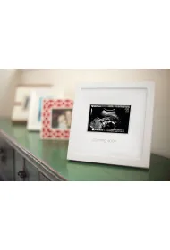 Ramka na zdj�cie USG "Sonogram"