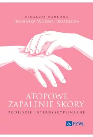 Atopowe zapalenie sk�ry. Podej�cie interdyscyplinarne