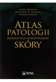 Atlas patologii z�o�liwych nowotwor�w sk�ry