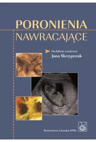Poronienia nawracaj�ce