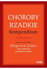 Choroby rzadkie. Kompendium