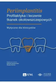 Periimplantitis. Profilaktyka i leczenie tkanek oko�owszczepowych