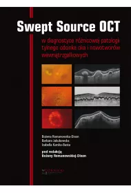 Swept Source OCT w diagnostyce patologii tylnego bieguna oka i nowotworw wewntrzgakowych
