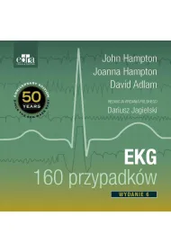 EKG 160 przypadk�w